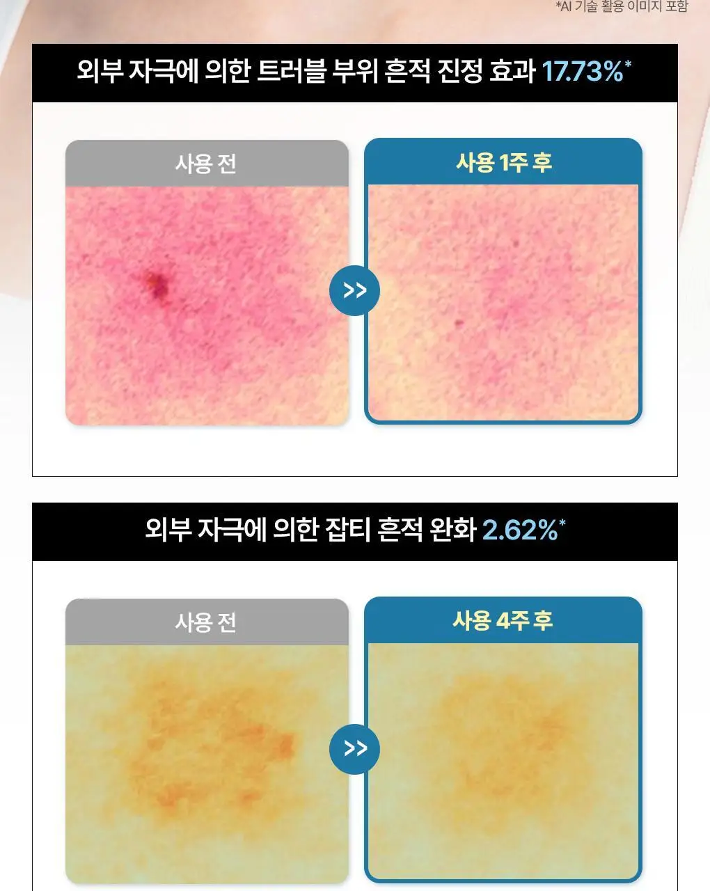 [앰플한병팩] 메디힐 하이퍼 마스크 1매 겔마스크 4종 (콜라겐/PDRN/마데카소사이드/히알루론산) 상세페이지 39